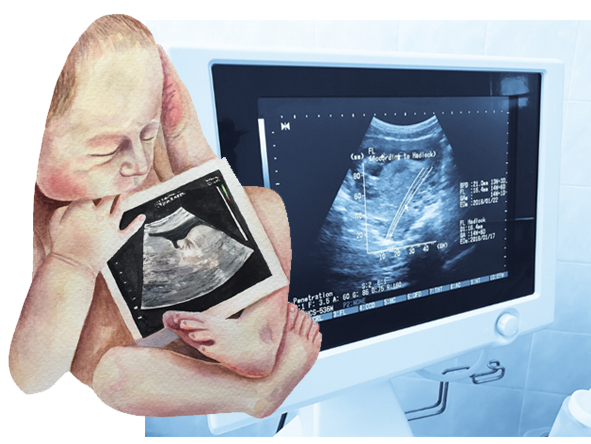 Prenatal Testing 2